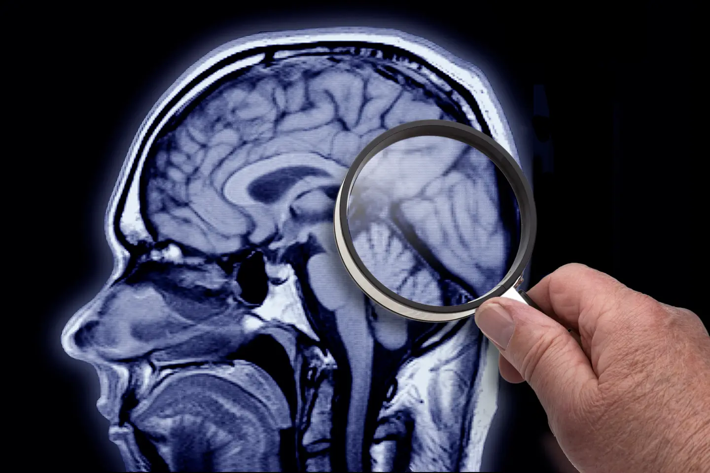 Reposição de vitamina C no cérebro “atrasa início e a progressão” da Doença de Alzheimer, conclui estudo